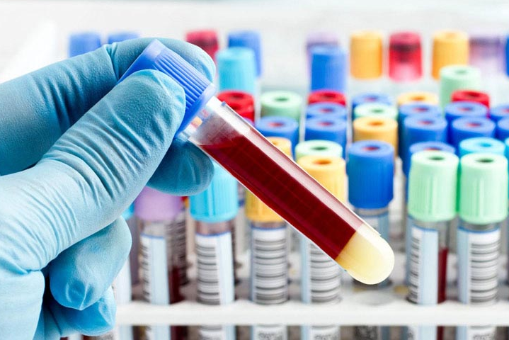 ECG and Blood Testing Lab in Dahisar