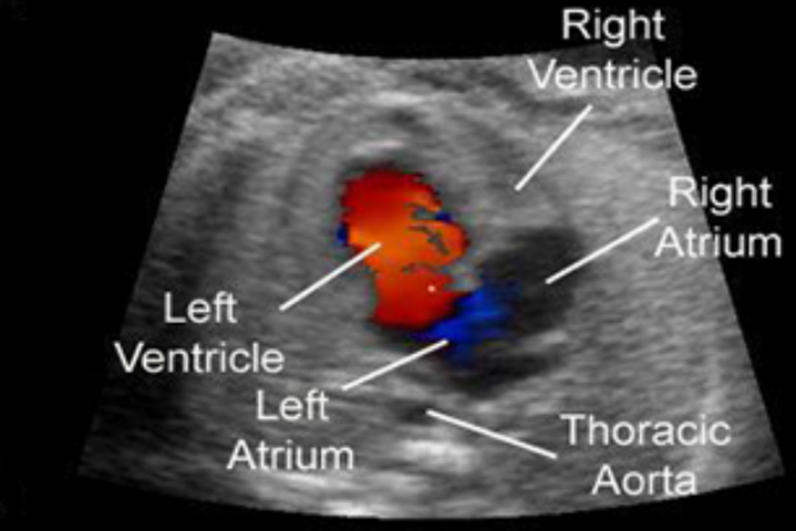 Colour Doppler And 2D - ECHO Centre in Dahisar
